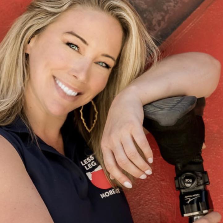 Support after limb loss: Less Leg More Heart to hold June 4 hold cornhole tourney at Bonfire post image
